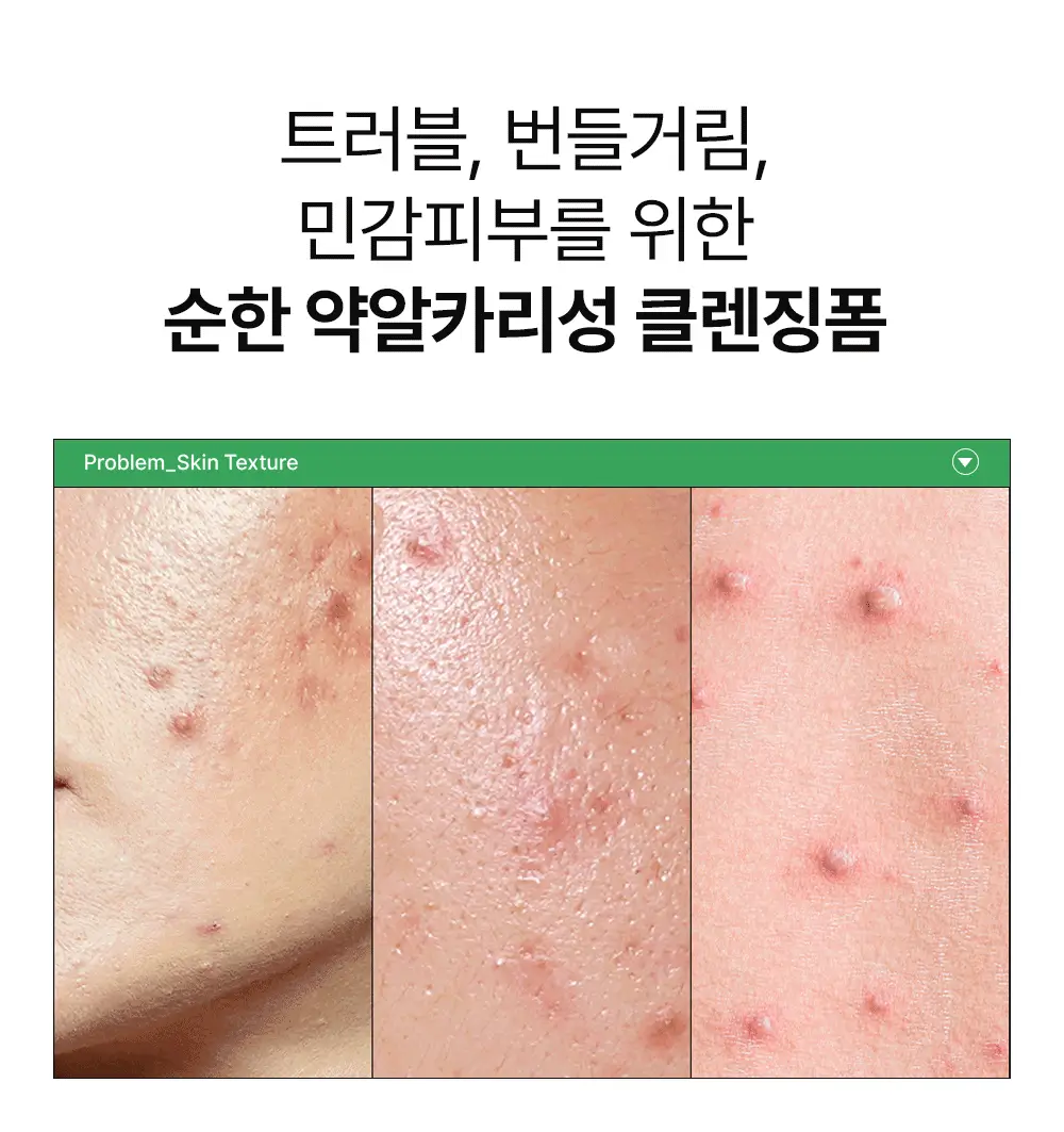 [여드름기능성/약알카리성] 비건이펙트 청보리 LHA 딥클렌징 폼 165ml 상세페이지 6